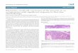 ematology & Medical ncology · 7. Wang L, Davidson DD, Montironi R, Lopez-Beltran A, Zhang S, et al. (2015) Small cell carcinoma of the prostate: molecular basis and clinical implications