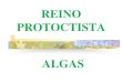 REINO PROTOCTISTAescola.unitau.br/files/arquivos/category_1/Profa_Luciana_REINO... · pigmentos (cor marrom) e reservam crisolaminarina. Vivem em ambientes aquáticos em geral, alta