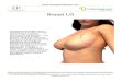 Breast Lift - Elena Prousskaia€¦ · Breast Ptosis and Surgical Technique During a breast lift procedure, excess skin is removed, the breast tissue is reshaped, and the remaining