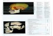 Большой атлас по анатомии человека - deus1.comdeus1.com/data/02-01-kosti-cherepa.pdf · 2016. 6. 2. · Кости черепа Общее строение