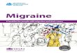 MigraineThere are three main types of migraine. Migraine with aura. This is when there are specific warning signs just before the migraine begins, such as seeing flashing lights. Migraine