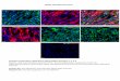 Kidney Fibroblast Panel - Cedarlane Pancytokeratin/FSP1-S100 Alpha-SMA Vimentin Samples tested above: Adult Donor 786 and 804. Passages 2, 3, 4, 6 Markers used: Anti-Fibroblast, Anti-FSP1S100