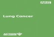 Lung Cancer - Easyhealth€¦ · practice nurse for advice. They will be able to help and support you while you are giving up smoking. 8. How to reduce your risks of getting Lung