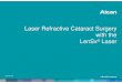 Laser Cataract Surgery - ncascade.com · Surgery on the Macula, Journal of Refractive Surgery, 2011;27:717-722. Miháltz K, Knorz MC, Alio JL, Takács A, Kránitz K, Kovács I, Nagy