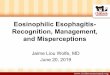 Eosinophilic Esophagitis- Recognition, Management, and ... · – Occasional heartburn – No choke/gag/cough – “Feels food go down” Differential Diagnosis-Dysphagia • Esophagitis