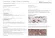 Anti-KIT / c-KIT / CD117 antibody · Catalog Number: 100538 2 / 2 c-Kit / CD117 Antibody, Rabbit MAb, Immunochemistry Immunochemical staining of human c-KIT in human melanoma with