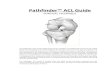 Pathfinder™ ACL Guide - DanaMed, Inc. · 2018. 7. 31. · Pathfinder ACL Guide Components The Pathfinder ACL Guide System is comprised of 1). Pathfinder Guides (reusable), and 2)