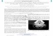 Lateral Cervical Mass as a First Sign of Metastases of ...€¦ · International Journal of Science and Research (IJSR) ISSN (Online): 2319-7064 Index Copernicus Value (2015): 78.96