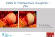 Update on femoroacetabular impingement (FAI) · What are Risk Factors for Revision after Hip Arthroscopy for FAI at 7-years ? 52 hips (FU 5-11y, mean 7) • 2 THA • 6 progressive