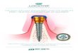 Zest Dental Solutions - THE ONLY IMPLANT ENGINEERED ......implant-retained overdenture option for patients. All-Inclusive packaging with industry leading Zest LOCATOR Abutments for