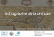 Echographie de la cirrhosenaxos.biomedicale.univ-paris5.fr/diue/wp-content/... · PREVALENCE de la Cirrhose Etiologie •Mal connue •1500 à 2000 / million en France Mortalité