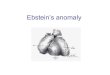 Ebstein’s anomaly · Ebstein’s anomaly-adult patient Indications for operation • Symptoms of dyspnea or right-sided heart failure (NYHA III-IY) • Progressive RV dilatation