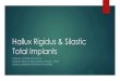 Hallux Rigidus & Silastic Total Implants Rigidus Sylastic Total Implants... · Septic arthritis Systemic arthridities Weak or absent peroneus longus Iatrogenic Trauma Neoplasms. Presentation
