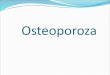 Osteoporoza - USMF · PDF file coloanei vertebrale, scolioza, chifoza, ghebul. Pot fi observate cauzele, care duc la osteoporoza secundară (hipogonadism, semne maladiilor tiroidiene,