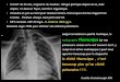 radiographie thoracique (et thoracique (et non pulmonaire comme on le voit souvent £©crit, y compris