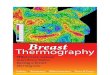 Breast Thermography...Thermography, in one form or another, goes back many years. A very quick overview of some of the highlights includes the following: Hippocrates noted that an