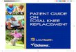 PATIENT GUIDE ON TOTAL KNEE REPLACEMENT...Total Knee Replacement Ortho Kenner Booklet.indd 7 12/23/13 2:19 PM 8 PATIENT TESTIMONIALS Dr. Vinod Dasa I had to have knee surgery last