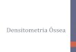 Densitometria Óssea · 2019. 12. 10. · Densitometria Óssea • Atenuação pelo corpo do paciente de um feixe de radiação gerado por uma fonte de raios X com dois níveis de