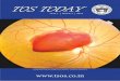 TOS TODAY 2 TOS Today...rpk@lvpei.org D ear Colleagues, Wish you a Great New Year 2016! This is the second issue Tos Today, the official Journal of the newly formed Telangana ophthalmological
