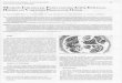 Turkish Journal of Pathology · 2014. 1. 8. · ya lobüler karsinoma in situ'nun bazl özelliklerini gösteren proliferatif lezyonlart atipik duktal hiperplazi (ADH) ve atipik 