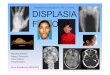 Proge1o’di’terapiagenicanellacuradella’ DISPLASIA FIBROSA...terapia gen displasia fibrosa.ppt Author Isabella Saggio Created Date 4/20/2011 2:32:55 PM 