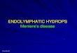 ENDOLYMPHATIC HYDROPS Meniere¢â‚¬â„¢s ... Failure of this function results in endolymphatic hydrops Bruce