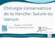 Chirurgie conservatrice de la Hanche: Suture du labrumcentre-orthopedique-santy.com/wp-content/uploads/2017/11/... · Samedi 18 Novembre 2017–Espace Tête d’Or –4ème Journée