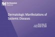 Dermatologic Manifestations of Systemic Diseases › system › files › documents › ...Dermatitis Herpetiformis •Extremely pruritic herpetiform vesicles on urticarial plaques