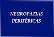 NEUROPATIAS PERIFÉRICAS · 2017. 3. 20. · Neuropatias Hereditárias Porfiria Aguda Intermitente Autossômica dominante, penetrância incompleta Fatores Precipitantes: drogas, álcool,