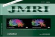 JOURNAL OF MAGNETIC RESONANCE IMAGING - Lobes · distortions in DW images by cross-correlating them with an undistorted baseline image in terms of scal-ing, shear, and translation