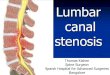 Lumbar canal · 2012. 3. 13. · Stenosis – “being narrow” A radicular syndrome from developmental narrowing of the lumbar vertebral canal. Verbiest H. JBJS (Br) 1954; 36-B: