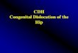 CDH Congenital Dislocation of the Hip - Aliah University · 2020. 4. 19. · A congenital hip dislocation is an abnormal formation of the hip joint that is present at birth. •Lt