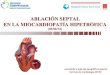 ABLACIÓN SEPTAL EN LA MIOCARDIOPATÍA HIPETRÓFICA · 2021. 2. 14. · Bloqueo AV completo persistente (10%): MCP definitivo. Disección coronaria (~1 %). Infarto de miocardio remoto