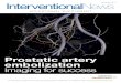 Prostatic artery embolization Imaging for success ... allergies and renal function. Urological evaluation, a urodynamic study (or Qmax) and a prostate specific antigen test are also