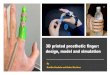 3D Printed Prosthetic Finger, Model, and Simulation printed... · 2021. 7. 28. · 3D printed prosthetic finger: design, model and simulation By Krutika Kanfade and Heber Martinez