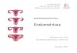 KONTINUIRANA EDUKACIJA Endometrioza