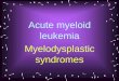 Acute myeloid leukemia Myelodysplastic syndromes