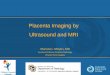 Placenta Imaging by Ultrasound and MRI