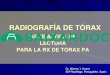 RADIOGRAFÍA DE TÓRAX - baixardoc.com
