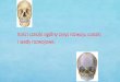 Kości czaszki ogólny zarys rozwoju czaszki i wady rozwojowe