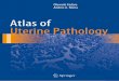 Atlas of Uterine Pathology - Booksca.ca