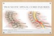 TRAUMATIC SPINAL CORD INJURIES - uogqueensmcf.com