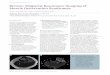 Review: Magnetic Resonance Imaging of Muscle Denervation 