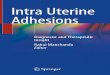 Intra Uterine Adhesions - download.e-bookshelf.de