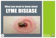 What you need to know about LYME DISEASE