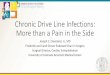 Chronic Drive Line Infections: More than a Pain in the Side