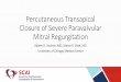 Percutaneous Transapical Closure of Severe Paravalvular 