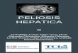 PELIOSIS HEPATICA