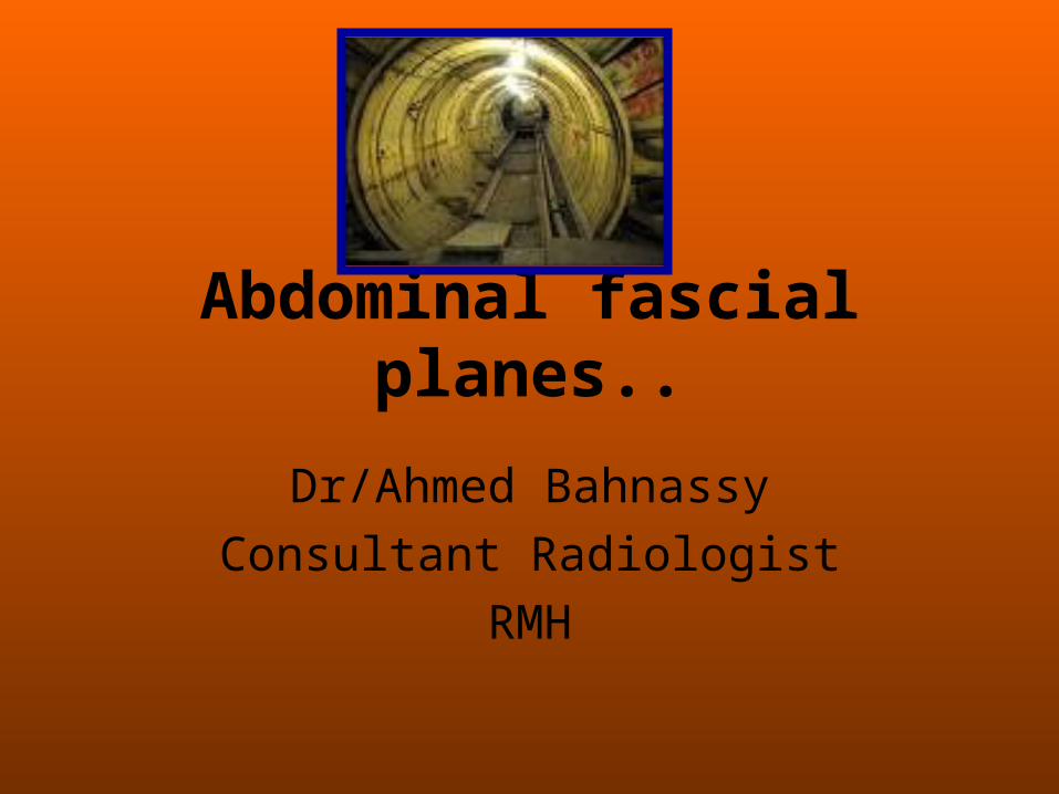(PPT) Radiological anatomy of abdominal spaces ...pathway of tumor and ...