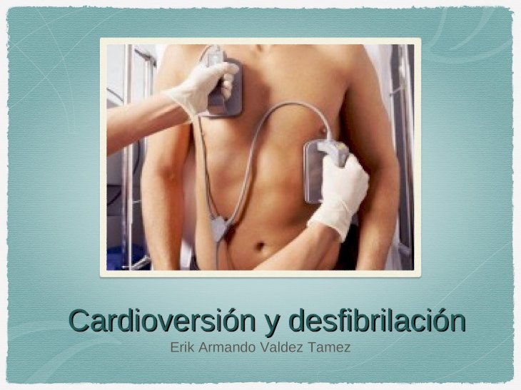 Ppt Cardioversion Y Desfibrilizacion Dokumen Tips